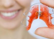 Рекомендації щодо лікування знімними апаратами