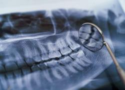 ОПТГ – зачем он в детской стоматологии?