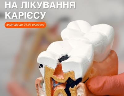 Скидка на лечение кариеса – 10%