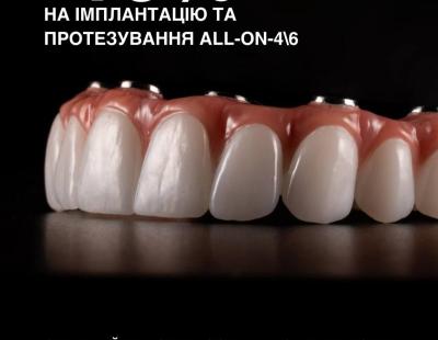 -10% на протезирование All-on-4/6
