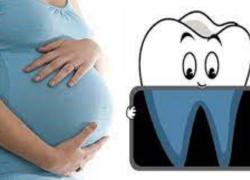 Рентген зубов во время беременности: риски и безопасность