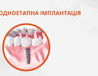 Одноэтапная имплантация зубов
