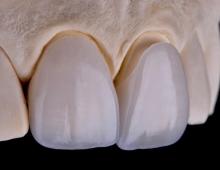 Изготовление диагностических моделей