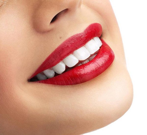 Де відбілити зуби у Запоріжжі