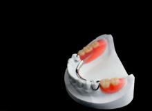 Рекомендації щодо знімного протезування