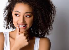 Рекомендації щодо брекет-системи