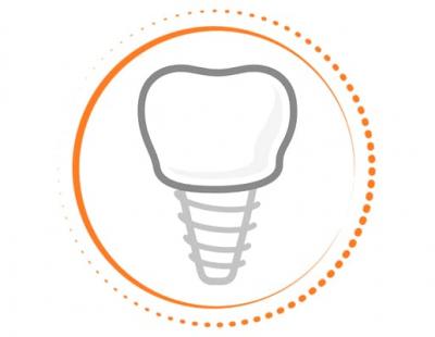 Імплантація та коронка за 1 день