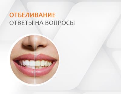 Питання – відповідь: Професійне відбілювання зубів