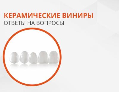 Керамічні вініри: відповіді на питання